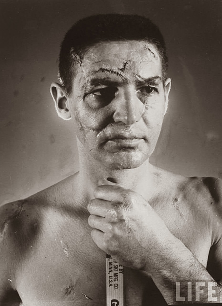 Le visage du gardien Terry Sawchuck capturé par Life Magasine. avant l'arrivé des masques.